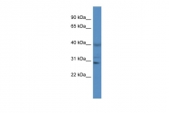ARP60953_P050 - Cathepsin S