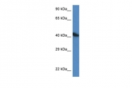 ARP60968_P050 - alpha skeletal muscle Actin / ACTA1
