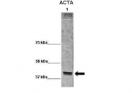 ARP60968_P050 - alpha skeletal muscle Actin / ACTA1