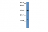 ARP60970_P050 - Trypsin-1 / PRSS1
