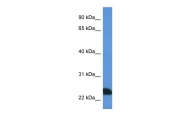 ARP60971_P050 - Trypsin-1 / PRSS1