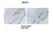 ARP60981_P050 - VEGF-A