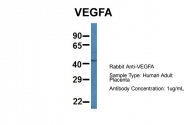 ARP60981_P050 - VEGF-A
