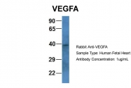 ARP60981_P050 - VEGF-A