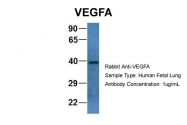 ARP60981_P050 - VEGF-A