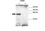 ARP61023_P050 - CD44