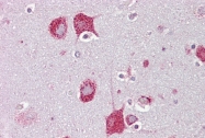 ARP61100_P050 - Beta-hexosaminidase alpha / HEXA