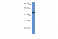 ARP61100_P050 - Beta-hexosaminidase alpha / HEXA