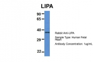 ARP61109_P050 - LIPA