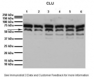 ARP61142_P050 - Apolipoprotein J / Apo J