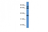 ARP61225_P050 - Deoxyhypusine synthase (DHPS)