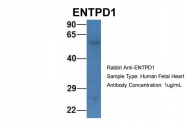 ARP61261_P050 - CD39 / ENTPD1