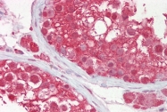 ARP61264_P050 - Cullin-3