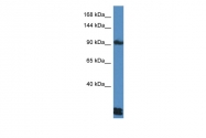 ARP61265_P050 - Desmoglein-3