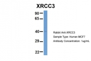 ARP61274_P050 - XRCC3