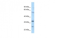 ARP61356_P050 - MAD2L1-binding protein