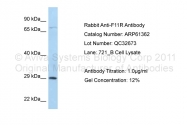 ARP61362_P050 - CD321 / JAM1
