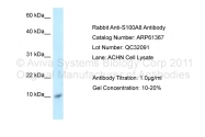 ARP61367_P050 - S100A8 / Calgranulin-A / MRP8
