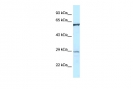 ARP61398_P050 - PTPN6