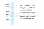 ARP61467_P050 - ROCK2