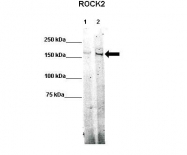 ARP61467_P050 - ROCK2