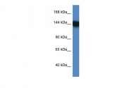 ARP61643_P050 - BAT3