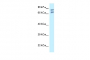 ARP61715_P050 - TNIP1