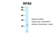 ARP61782_P050 - RPS9