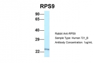 ARP61782_P050 - RPS9