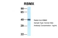 ARP61802_P050 - RBMX / HNRPG