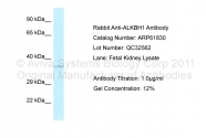 ARP61830_P050 - ALKBH1