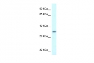 ARP61889_P050 - PDLIM1