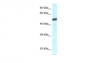 ARP61921_P050 - TBL1XR1