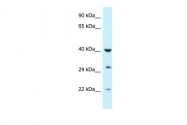 ARP61943_P050 - Galactokinase 1