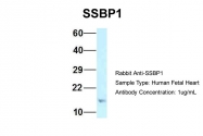 ARP61972_P050 - SSBP1