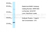 ARP61983_P050 - RAB31 / RAB22B