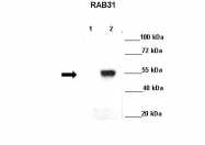 ARP61983_P050 - RAB31 / RAB22B