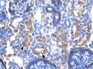 AVARP00015_T100 - Alpha-1-antitrypsin