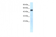 AVARP00015_T100 - Alpha-1-antitrypsin