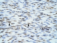 AVARP00019_P050 - NLRC4