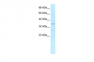 AVARP00019_P050 - NLRC4