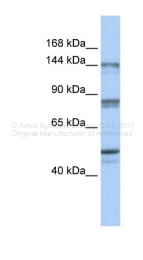 AVARP00023_P050 - XPO2 / Exportin-2