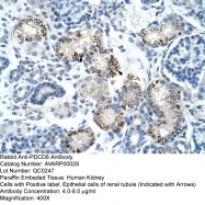 AVARP00028_P050 - AIFM1 / AIF