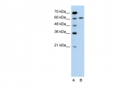 AVARP00028_P050 - AIFM1 / AIF