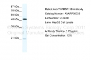 AVARP00033_T100 - Osteoprotegerin / TNFRSF11B