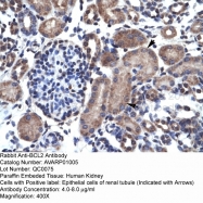 AVARP01005_P050 - Bcl-2