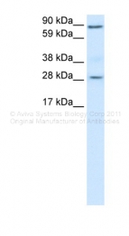 AVARP01005_P050 - Bcl-2