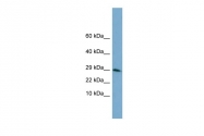AVARP01011_P050 - Histone H3.3