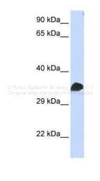 AVARP01020_P050 - CDK1
