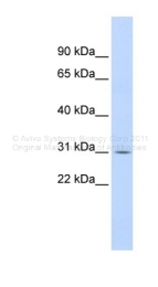 AVARP01037_P050 - NFKBIA / IKBA